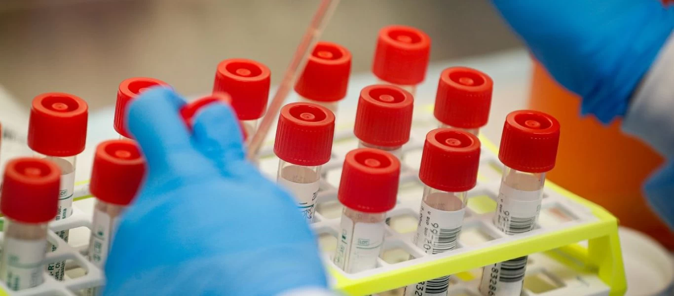 Κορωνοϊός: Στη Νάπολη θα κάνουν πλέον κατ' οίκον τεστ